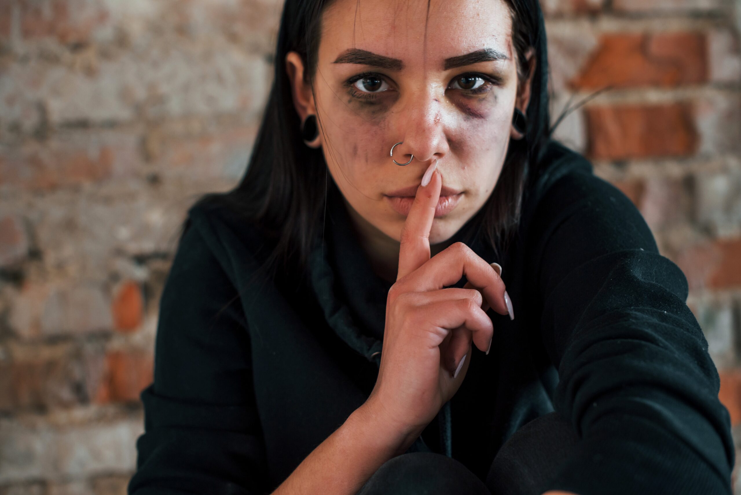 Portrait of beaten young woman with bruise under eye that shows silence gesture by finger indoors